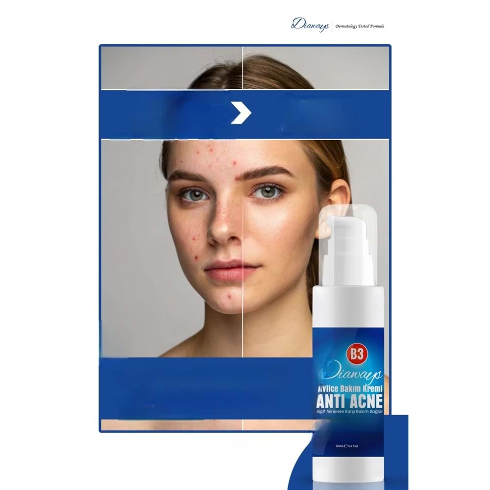 DİAWAYS 100ml Cilt Bakım Kremi